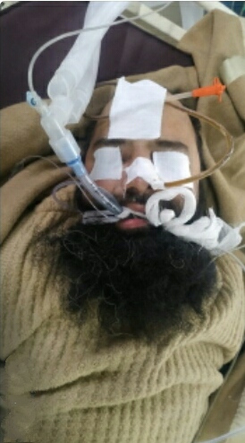 Injured Militant Admitted at SMHS Hospital Succumbs