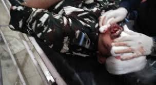 CRPF officer sustains critical injuries in collision