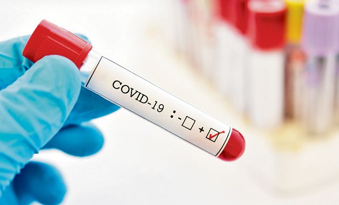2 deaths, 77 fresh covid-19 cases reported in J&K