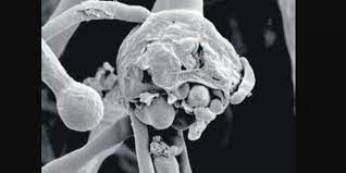 This year’s first suspected case of Black Fungus admitted at GDC Sgr
