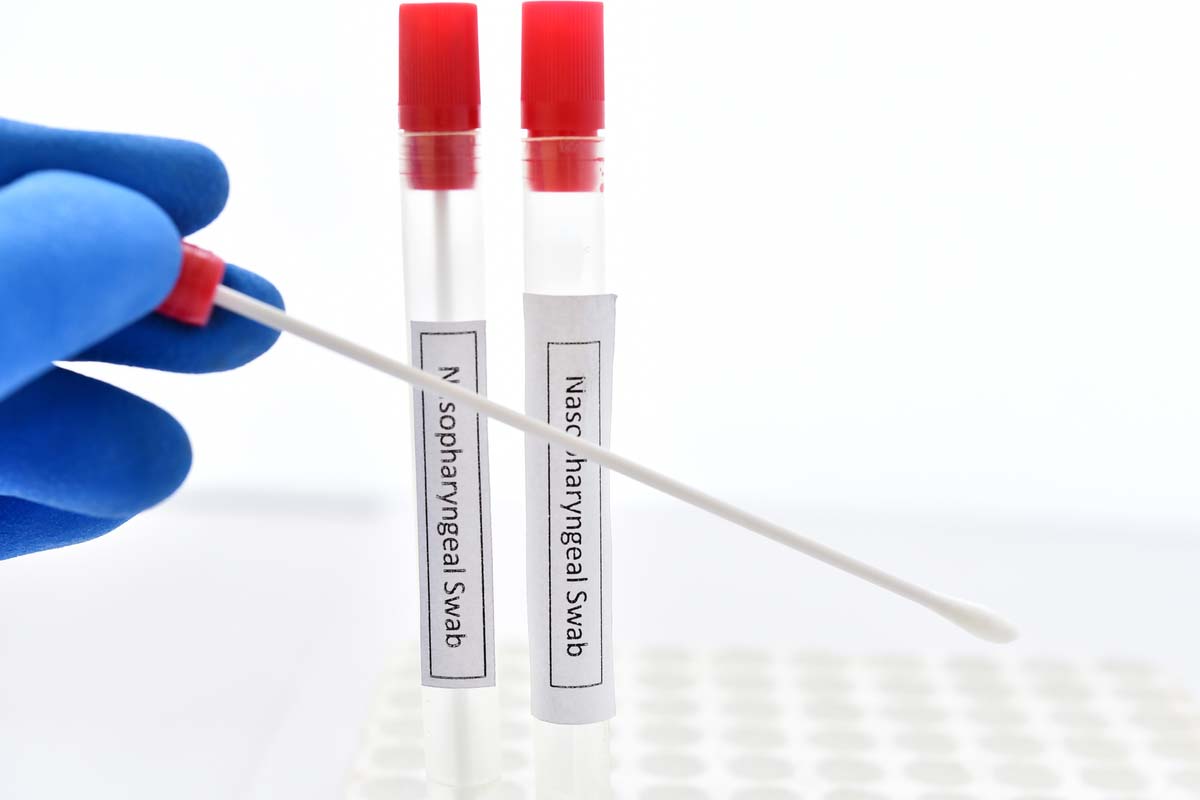 Not Charge More Than Rs 400 for RT-PCR Test in J&K: Govt Directs to Private Laboratories