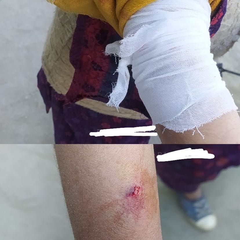 54-yr-old woman injured in leopard attack at Gbl