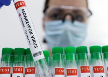 Suspected monkeypox cases detected in Uri