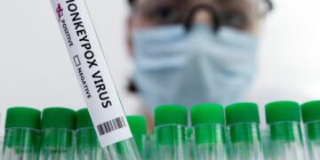 Suspected monkeypox cases detected in Uri